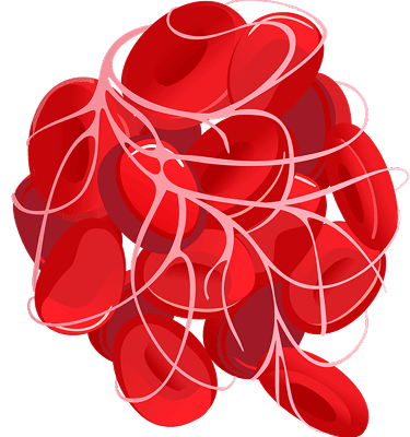Blood Clot