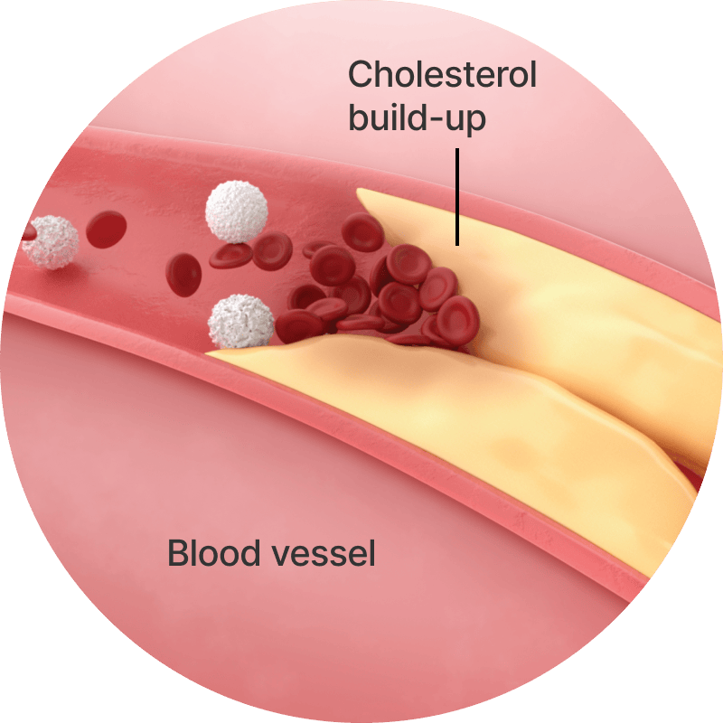 Cholesterol