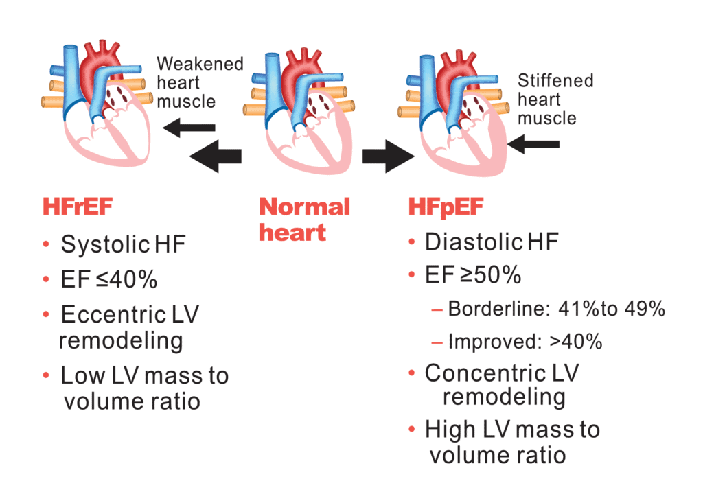 The Diagnosis PCNA Heart Failure Guide The Diagnosis PCNA Heart Failure Guide